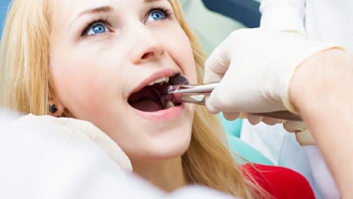 What You Need to Know Before Getting a Wisdom Tooth Extraction