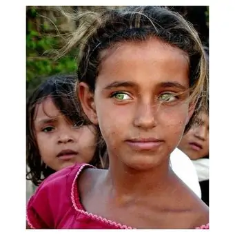 Green eyes