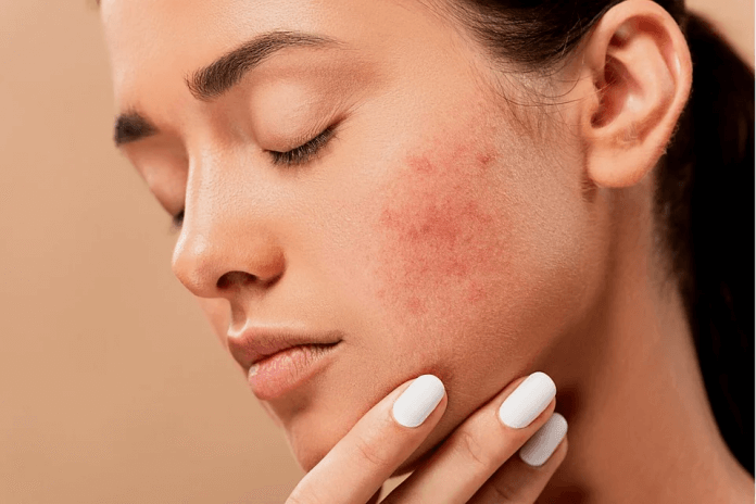 Problems and solutions regarding our skin